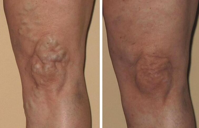 Experiences with Veniselle from Alice from Prague, before and after photos
